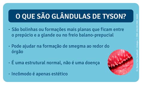 Glândulas de Tyson: o que é, causas e sintomas